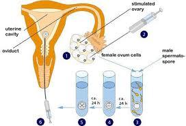 培养箱