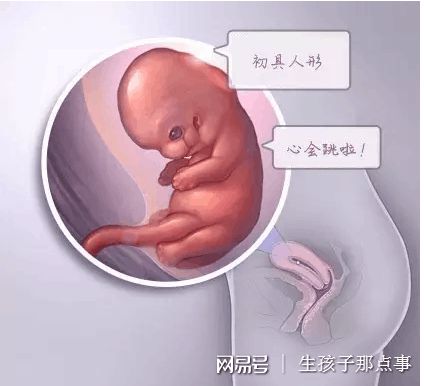 李雪梅